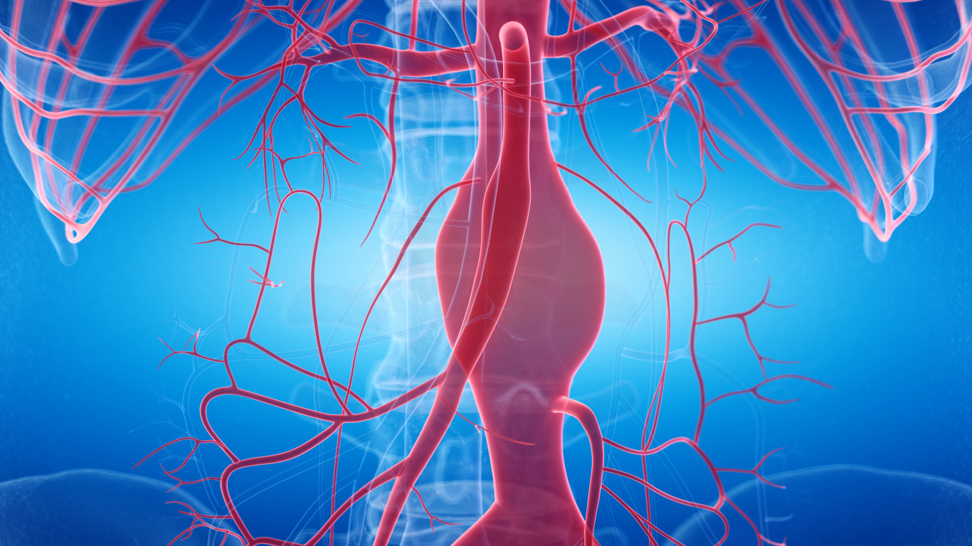Veias e artérias em raio x, para falar sobre o aneurisma da aorta