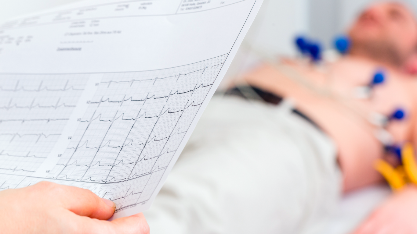 Médico explicando ao paciente sobre a fibrilação atrial